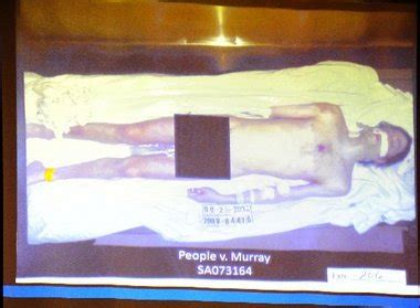 Michael Jackson Autopsy Photo Shown in Conrad Murray